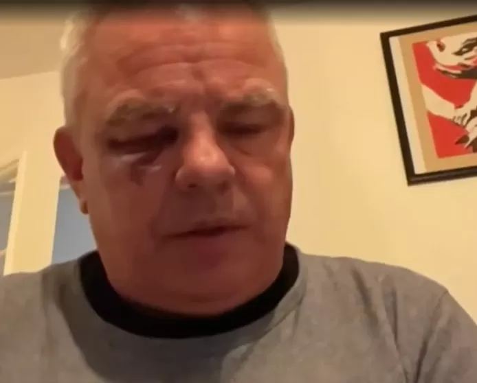 “Ils ont tenu des propos racistes”: l’agression d’un maire français par des “nationalistes” suscite l’indignation